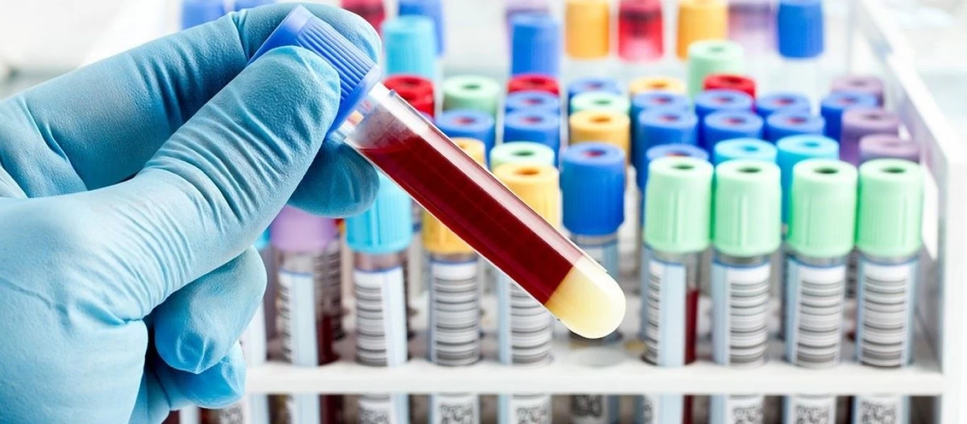 Αυτή η εξέταση βοηθάει στην πρόβλεψη εγκεφαλικού επεισοδίου και άνοιας